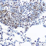 Immunohistochemistry - Anti-Casein Kinase 2 beta Antibody (A329171) - Antibodies.com