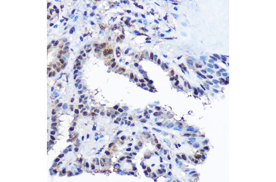 Immunohistochemistry - Anti-Casein Kinase 2 beta Antibody (A329171) - Antibodies.com