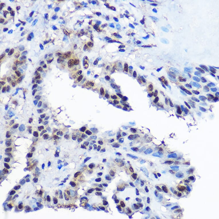 Immunohistochemistry - Anti-Casein Kinase 2 beta Antibody (A329171) - Antibodies.com