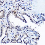 Immunohistochemistry - Anti-Casein Kinase 2 beta Antibody (A329171) - Antibodies.com
