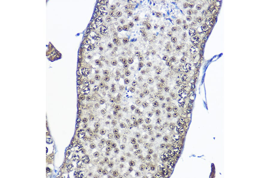 Immunohistochemistry - Anti-Casein Kinase 2 beta Antibody (A329171) - Antibodies.com