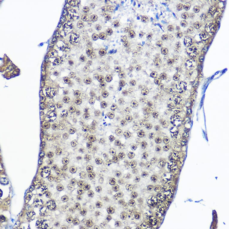 Immunohistochemistry - Anti-Casein Kinase 2 beta Antibody (A329171) - Antibodies.com