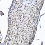 Immunohistochemistry - Anti-Casein Kinase 2 beta Antibody (A329171) - Antibodies.com