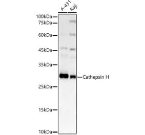 Western Blot - Anti-Cathepsin H Antibody [ARC3082] (A329176) - Antibodies.com