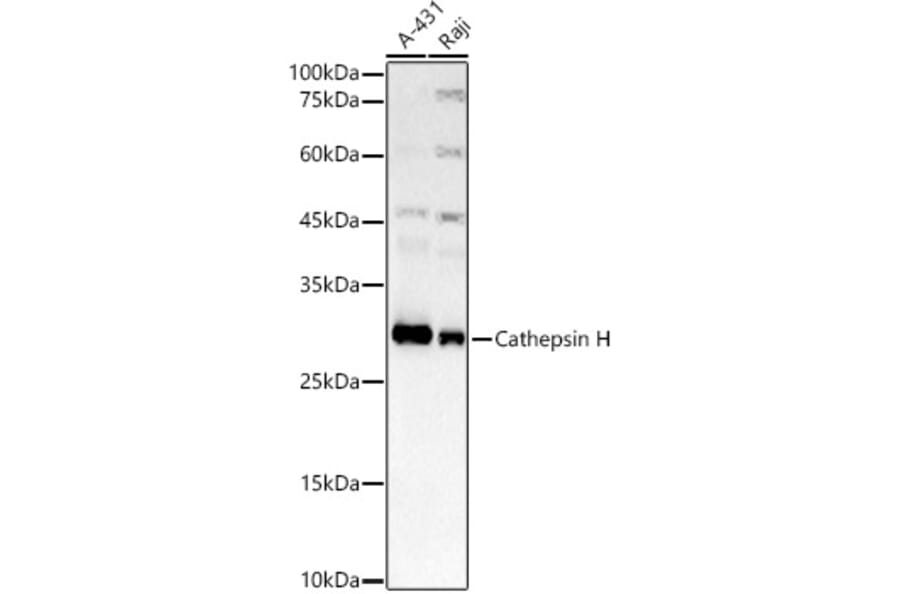 Western Blot - Anti-Cathepsin H Antibody [ARC3082] (A329176) - Antibodies.com