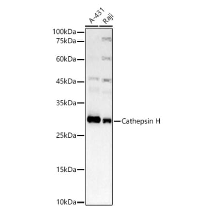 Western Blot - Anti-Cathepsin H Antibody [ARC3082] (A329176) - Antibodies.com