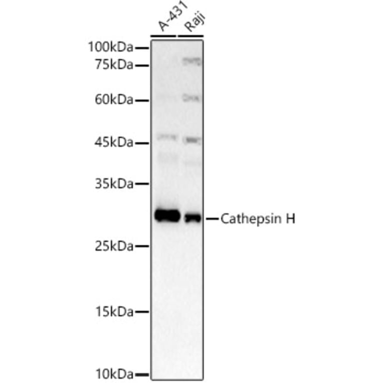 Western Blot - Anti-Cathepsin H Antibody [ARC3082] (A329176) - Antibodies.com