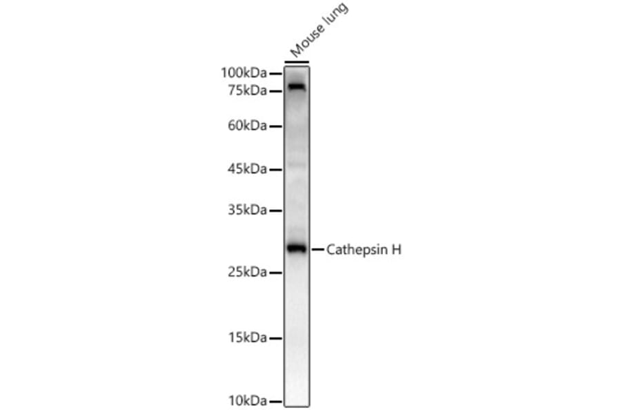 Western Blot - Anti-Cathepsin H Antibody [ARC3082] (A329176) - Antibodies.com