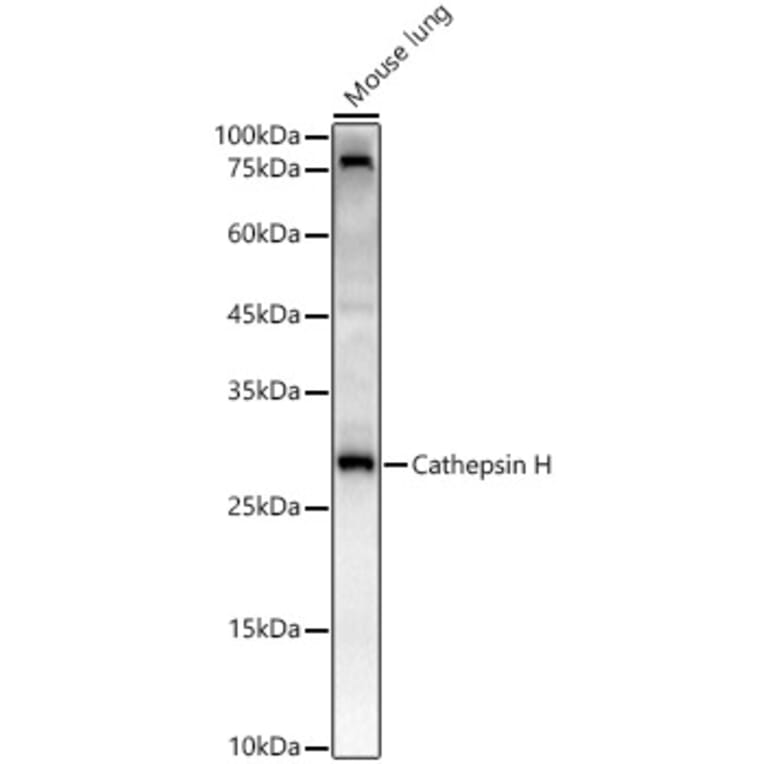 Western Blot - Anti-Cathepsin H Antibody [ARC3082] (A329176) - Antibodies.com