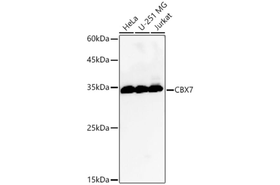 Western Blot - Anti-CBX7 Antibody (A329177) - Antibodies.com
