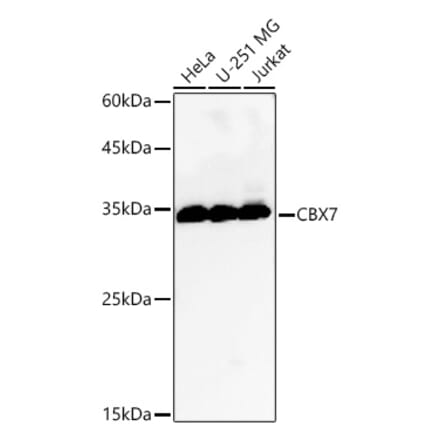Western Blot - Anti-CBX7 Antibody (A329177) - Antibodies.com