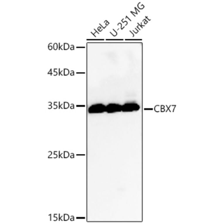 Western Blot - Anti-CBX7 Antibody (A329177) - Antibodies.com