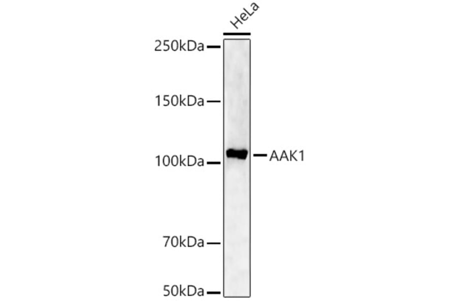 Western Blot - Anti-CCL17 Antibody (A329178) - Antibodies.com