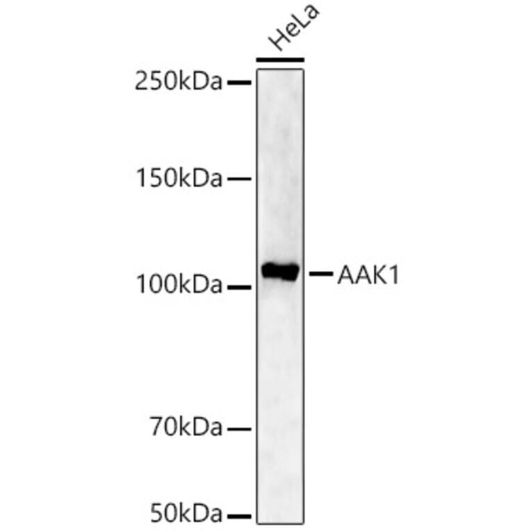 Western Blot - Anti-CCL17 Antibody (A329178) - Antibodies.com