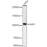 Western Blot - Anti-CCL17 Antibody (A329178) - Antibodies.com