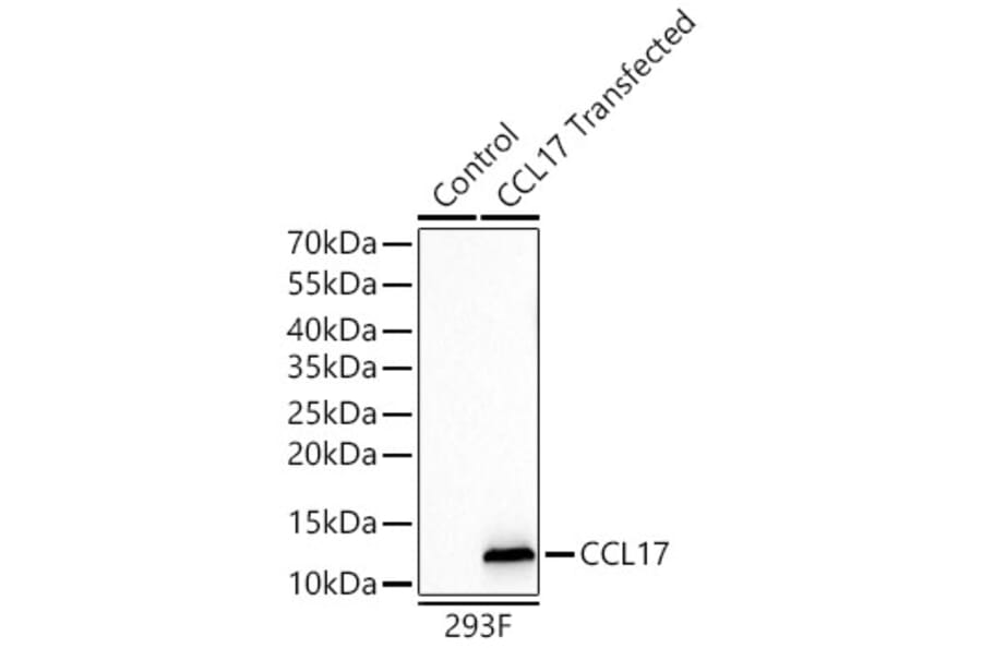 Western Blot - Anti-CCL17 Antibody [ARC65355] (A329179) - Antibodies.com