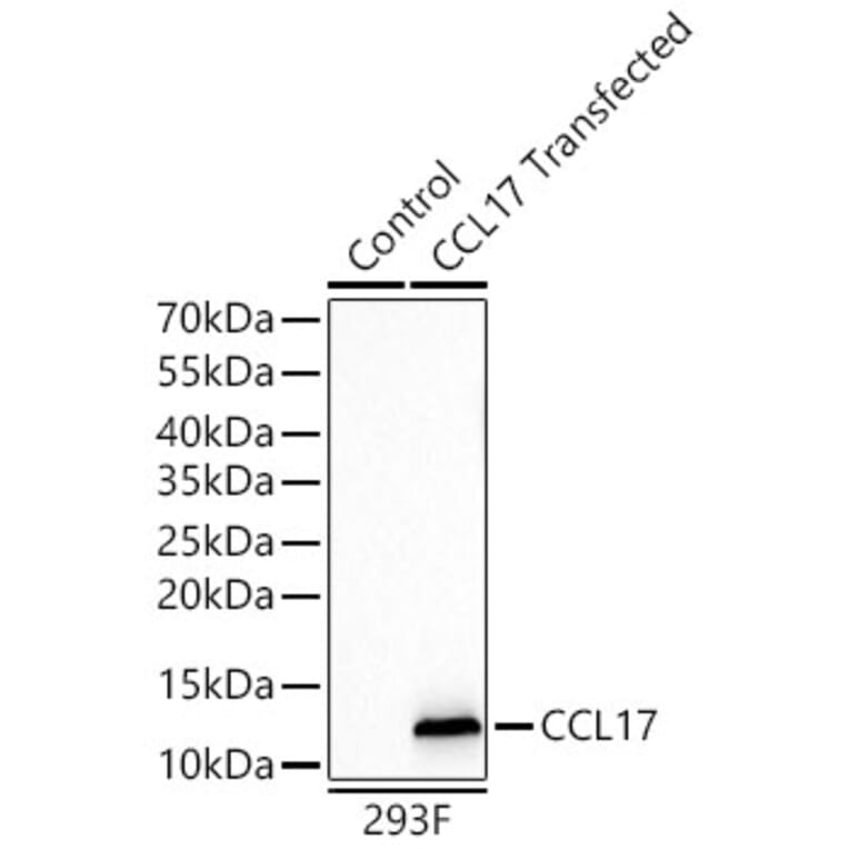 Western Blot - Anti-CCL17 Antibody [ARC65355] (A329179) - Antibodies.com