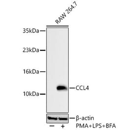 Western Blot - Anti-CCL4 Antibody (A329181) - Antibodies.com