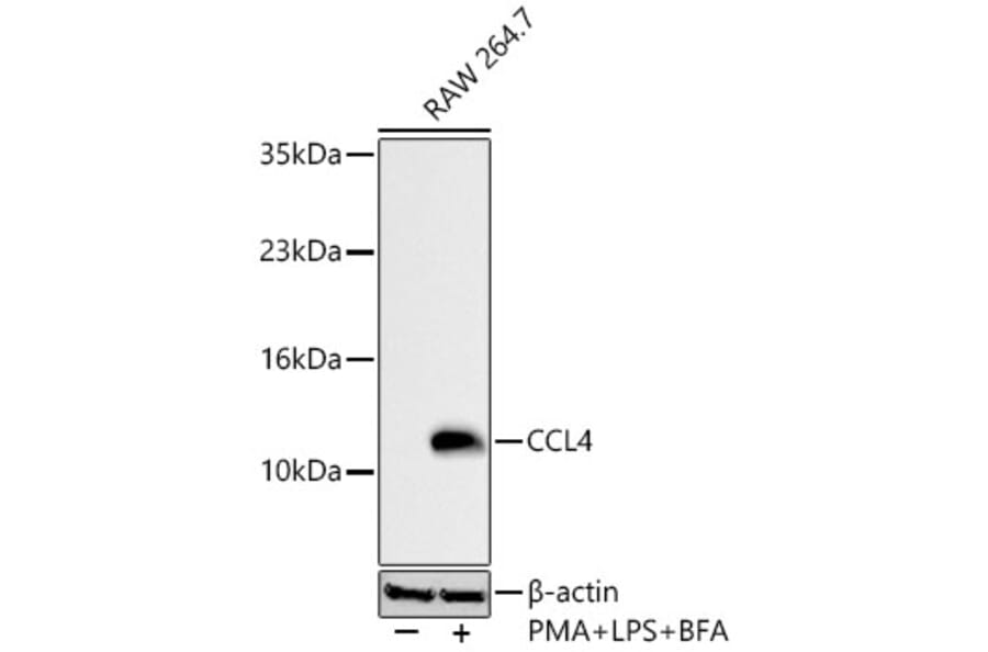 Western Blot - Anti-CCL4 Antibody (A329181) - Antibodies.com