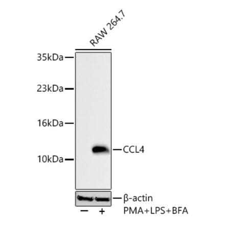Western Blot - Anti-CCL4 Antibody (A329181) - Antibodies.com
