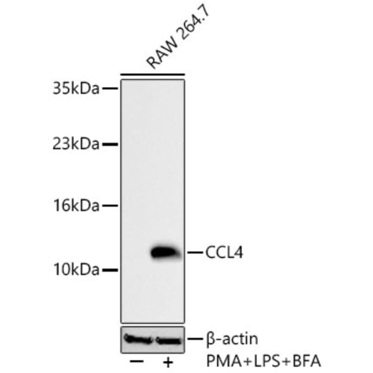Western Blot - Anti-CCL4 Antibody (A329181) - Antibodies.com