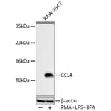 Western Blot - Anti-CCL4 Antibody (A329181) - Antibodies.com