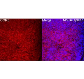 Immunofluorescence - Anti-CCR5 Antibody (A329182) - Antibodies.com