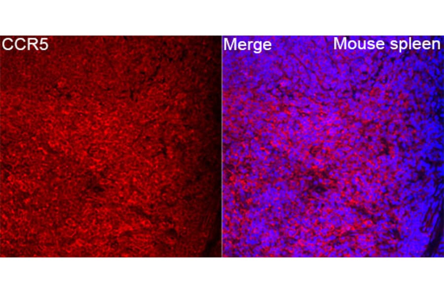Immunofluorescence - Anti-CCR5 Antibody (A329182) - Antibodies.com