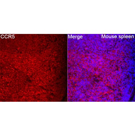 Immunofluorescence - Anti-CCR5 Antibody (A329182) - Antibodies.com