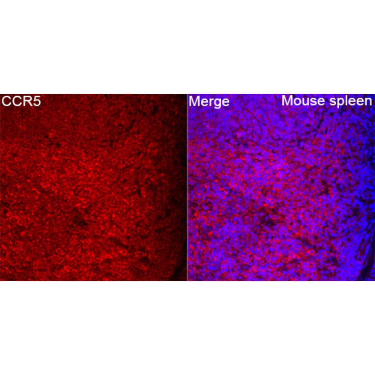 Immunofluorescence - Anti-CCR5 Antibody (A329182) - Antibodies.com
