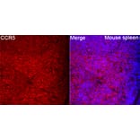 Immunofluorescence - Anti-CCR5 Antibody (A329182) - Antibodies.com