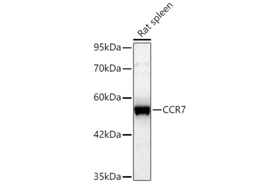 Western Blot - Anti-CCR7 Antibody (A329183) - Antibodies.com