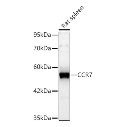 Western Blot - Anti-CCR7 Antibody (A329183) - Antibodies.com