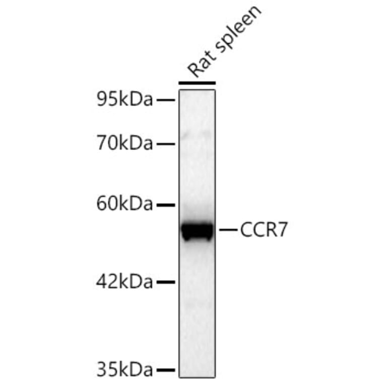 Western Blot - Anti-CCR7 Antibody (A329183) - Antibodies.com