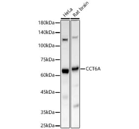 Western Blot - Anti-CCT6A Antibody (A329184) - Antibodies.com