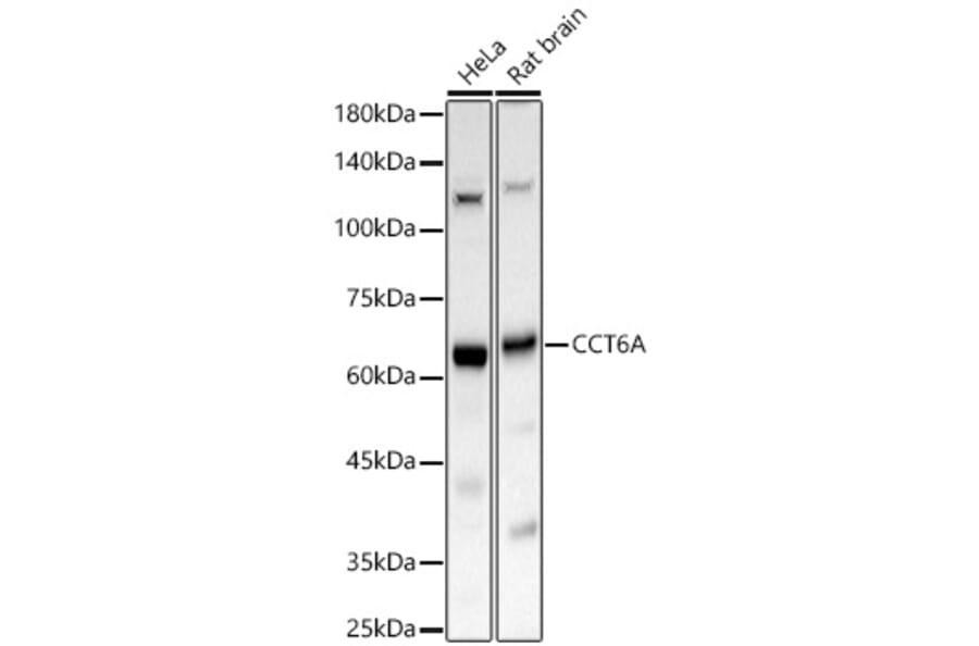 Western Blot - Anti-CCT6A Antibody (A329184) - Antibodies.com