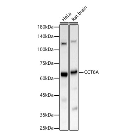 Western Blot - Anti-CCT6A Antibody (A329184) - Antibodies.com