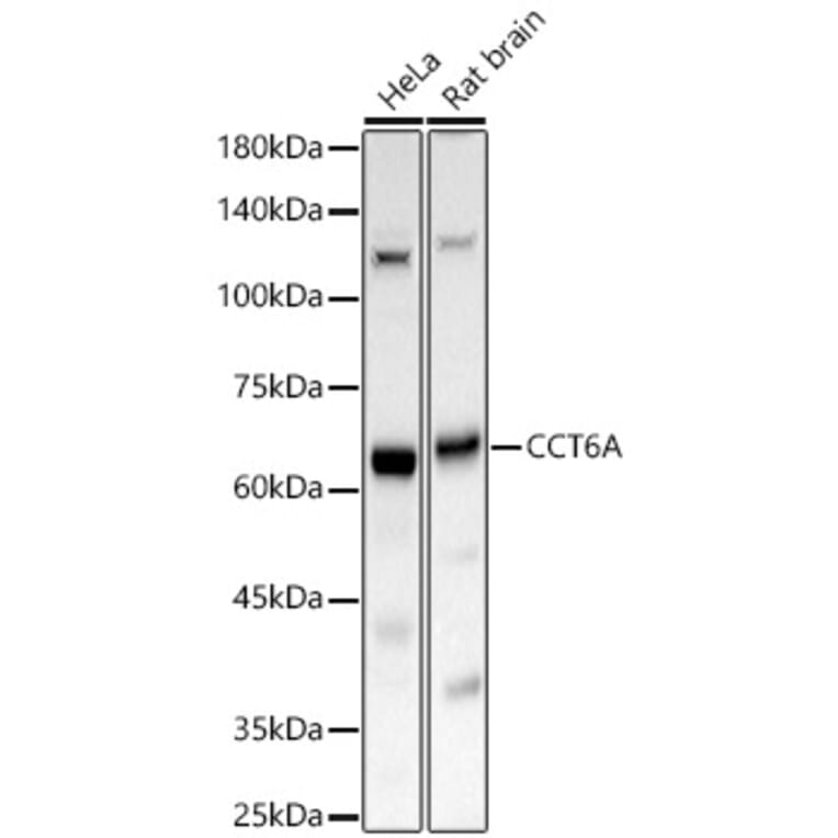 Western Blot - Anti-CCT6A Antibody (A329184) - Antibodies.com