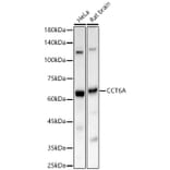 Western Blot - Anti-CCT6A Antibody (A329184) - Antibodies.com