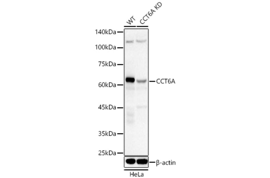 Western Blot - Anti-CCT6A Antibody (A329184) - Antibodies.com