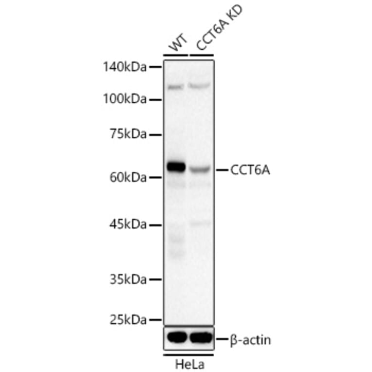 Western Blot - Anti-CCT6A Antibody (A329184) - Antibodies.com