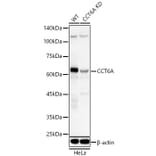 Western Blot - Anti-CCT6A Antibody (A329184) - Antibodies.com