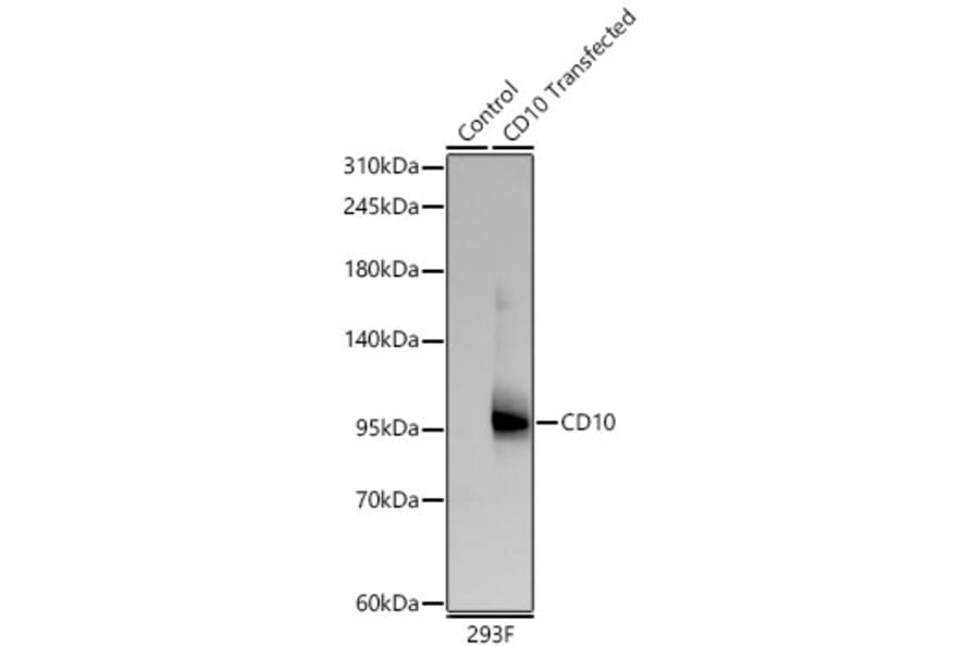 Western Blot - Anti-CD10 Antibody [ARC67050] (A329185) - Antibodies.com