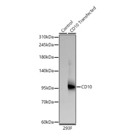 Western Blot - Anti-CD10 Antibody [ARC67050] (A329185) - Antibodies.com