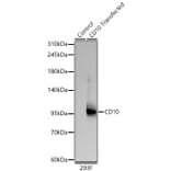 Western Blot - Anti-CD10 Antibody [ARC67050] (A329185) - Antibodies.com