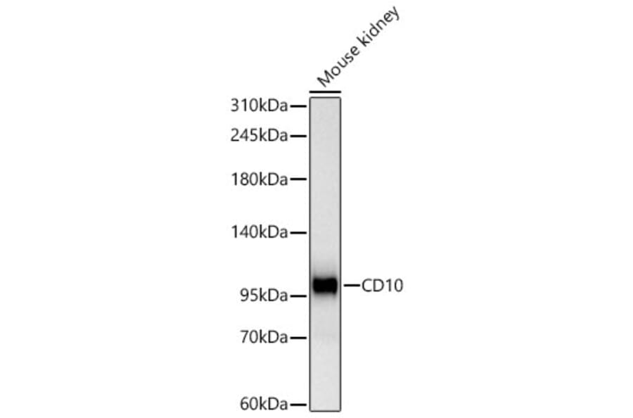 Western Blot - Anti-CD10 Antibody [ARC67050] (A329185) - Antibodies.com