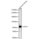 Western Blot - Anti-CD10 Antibody [ARC67050] (A329185) - Antibodies.com
