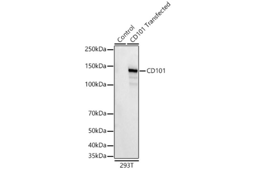 Western Blot - Anti-CD101 Antibody [ARC62044] (A329187) - Antibodies.com