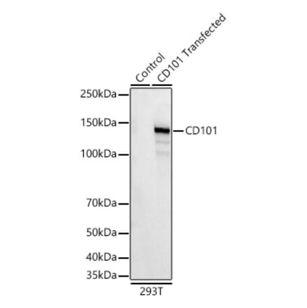 Western Blot - Anti-CD101 Antibody [ARC62044] (A329187) - Antibodies.com