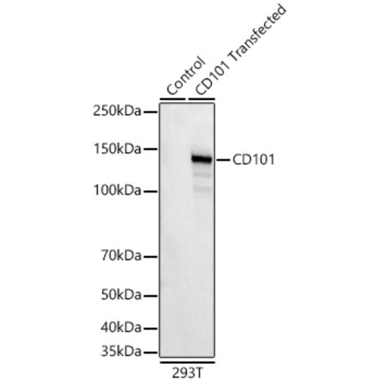 Western Blot - Anti-CD101 Antibody [ARC62044] (A329187) - Antibodies.com